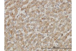 Immunoperoxidase of monoclonal antibody to DDX56 on formalin-fixed paraffin-embedded human liver. (DDX56 抗体  (AA 450-547))