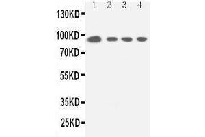 Anti-STAT5a antibody, Western blotting Lane 1: HELA Cell Lysate Lane 2: COLO320 Cell Lysate Lane 3: JURKAT Cell Lysate Lane 4: CEM Cell Lysate (STAT5A 抗体  (C-Term))