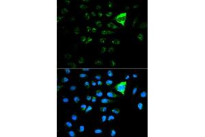 Immunofluorescence analysis of MCF7 cell using CDKN1A antibody. (p21 抗体  (AA 43-142))