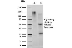 SDS-PAGE Analysis Purified CD27 Mouse Monoclonal Antibody (203. (CD27 抗体)