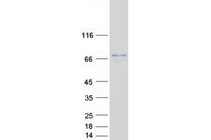 Validation with Western Blot