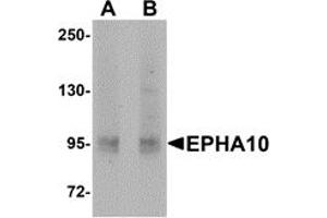 Western Blotting (WB) image for anti-EPH Receptor A10 (EPHA10) (N-Term) antibody (ABIN1031373) (EPH Receptor A10 抗体  (N-Term))