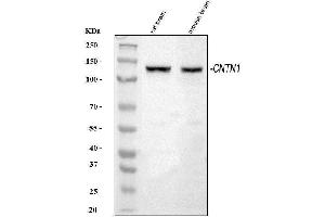 Western blot analysis of Contactin 1/CNTN1 using anti-Contactin 1/CNTN1 antibody (ABIN7600719).