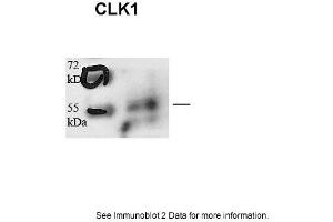 Sample type: human microvascular endothelial cells (25ug)Primary Dilution: 1:1000Secondary Antibody: Goat anti-Rabbit-HRPSecondary Dilution: 1:5000Image Submitted by: Andreas Eisenreich Charite Universitatsmedizin Berlin (CLK1 抗体  (N-Term))