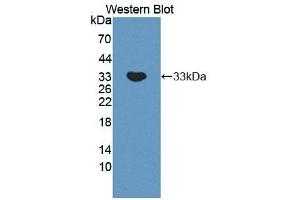 Detection of Recombinant PLCb2, Mouse using Polyclonal Antibody to Phospholipase C Beta 2 (PLCb2) (Phospholipase C beta 2 抗体  (AA 1-250))