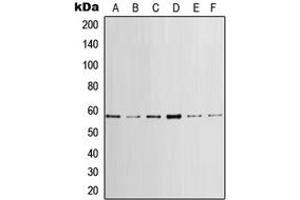Western blot analysis of LCK expression in HeLa (A), MCF7 (B), mouse brain (C), mouse heart (D), rat brain (E), rat heart (F) whole cell lysates. (LCK 抗体  (Center))