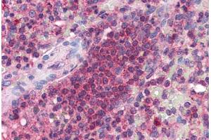 Human Spleen (formalin-fixed, paraffin-embedded) stained with ARMETL1 antibody ABIN351454 at 5 ug/ml followed by biotinylated goat anti-rabbit IgG secondary antibody ABIN481713, alkaline phosphatase-streptavidin and chromogen. (CDNF 抗体  (C-Term))