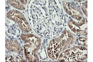 Image no. 1 for anti-butyrobetaine (Gamma), 2-Oxoglutarate Dioxygenase (Gamma-butyrobetaine Hydroxylase) 1 (BBOX1) antibody (ABIN1496815) (BBOX1 抗体)