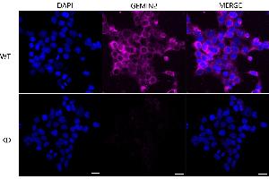 anti-Gem (Nuclear Organelle) Associated Protein 2 (GEMIN2) antibody