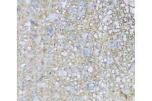 Immunohistochemistry of paraffin-embedded Rat brain using ATP1B2 Polyclonal Antibody at dilution of 1:100 (40x lens). (ATP1B2 抗体)