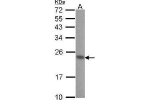 WB Image Sample (30 ug of whole cell lysate) A: A431 , 12% SDS PAGE CIB1 antibody antibody diluted at 1:1000 (CIB1 抗体)