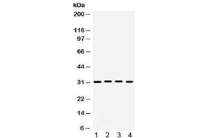 Western blot testing of 1) rat brain, 2) rat heart, 3) mouse heart and 4) human 22RV1 lysate with KChIP2 antibody. (KCNIP2 抗体)