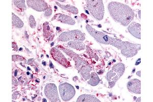 Anti-CXCR4 antibody IHC of human heart. (CXCR4 抗体  (C-Term))
