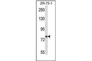 Western blot analysis of SIM1 Antibody (N-term) in ZR-75-1 cell line lysates (35ug/lane). (SIM1 抗体  (N-Term))