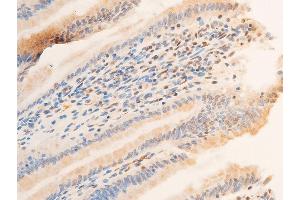 ABIN6256329 and ABIN6267218 at 1/100 staining rat intestinal tissue sections by IHC-P. (SGK1 抗体  (pSer422))