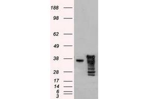 Image no. 1 for anti-DNA Fragmentation Factor, 45kDa, alpha Polypeptide (DFFA) antibody (ABIN1498773) (DFFA 抗体)