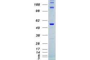 Western Blotting (WB) image for serine/threonine Kinase 4 (STK4) protein (Myc-DYKDDDDK Tag) (ABIN2732890)