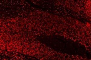 IF analysis of SAE1 using anti-SAE1 antibody (ABIN7601346).