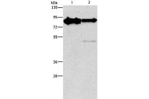 Western Blot analysis of Mouse brain and Human brain malignant glioma tissue using KIF3A Polyclonal Antibody at dilution of 1:750 (KIF3A 抗体)