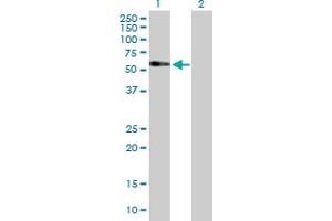 Western Blot analysis of FAM98A expression in transfected 293T cell line by FAM98A MaxPab polyclonal antibody. (FAM98A 抗体  (AA 1-518))