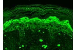 Immunohistochemistry (IHC) image for anti-Glutamate Receptor, Ionotropic, N-Methyl D-Aspartate 2B (GRIN2B) (AA 20-271) antibody (Biotin) (ABIN2483216)