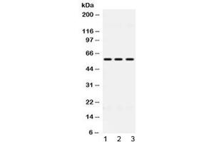 Western blot testing of 1) rat liver, 2) mouse HEPA and 3) human HeLa lysate with ALDH7A1 antibody at 0.