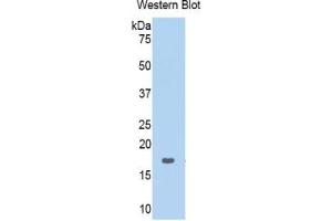 Western Blotting (WB) image for Ribophorin 1 (RPN1) ELISA Kit (ABIN6720498)