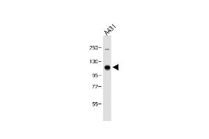 Anti-DDR1 Antibody (Center) at 1:500 dilution + A431 whole cell lysate Lysates/proteins at 20 μg per lane.