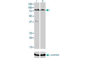 Western Blotting (WB) image for anti-Calcium Responsive Transcription Factor (CARF) (AA 621-719) antibody (ABIN599306) (Calcium Responsive Transcription Factor (CARF) (AA 621-719) 抗体)