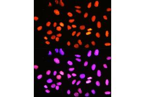 Immunofluorescence analysis of U-2 OS cells using DNA topoisomerase I (DNA topoisomerase I (TOP1)) Rabbit mAb (ABIN7270850) at dilution of 1:100 (40x lens). (Topoisomerase I 抗体)
