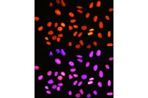 Immunofluorescence analysis of U-2 OS cells using DNA topoisomerase I (DNA topoisomerase I (TOP1)) Rabbit mAb (ABIN7270850) at dilution of 1:100 (40x lens). (Topoisomerase I 抗体)