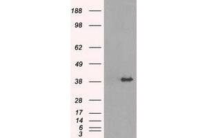 Image no. 1 for anti-Tribbles Pseudokinase 2 (TRIB2) antibody (ABIN1501501) (TRIB2 抗体)