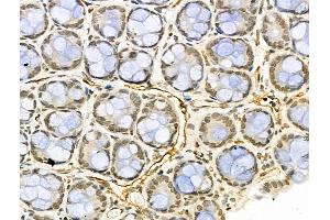 ABIN6264433 and ABIN6276469 at 1/100 staining Rat stomach tissue by IHC-P. (PRMT1 抗体  (C-Term))