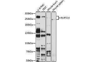 Western blot analysis of extracts of various cell lines, using NUP214 antibody (ABIN6127536, ABIN6144958, ABIN6144959 and ABIN6224385) at 1:1000 dilution. (NUP214 抗体  (AA 750-1030))