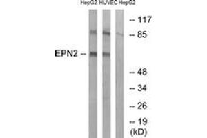 Western blot analysis of extracts from HepG2/HuvEc cells, using EPN2 Antibody. (Epsin 2 抗体  (AA 271-320))