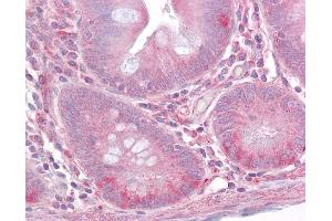 Anti-TLR1 antibody IHC of human small intestine. (TLR1 抗体  (AA 400-450))