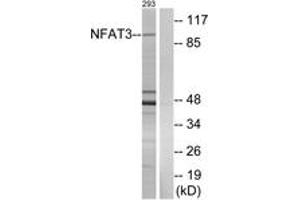 Western blot analysis of extracts from 293 cells, using NFAT3 (Ab-676) Antibody.