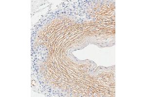 Immunohistochemistry (Paraffin-embedded Sections) (IHC (p)) image for anti-Sciellin (SCEL) (AA 260-289) antibody (ABIN655511)