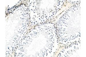 ABIN7093286 and ABIN7097305 at 1/100 staining Rat testis tissue by IHC-P.