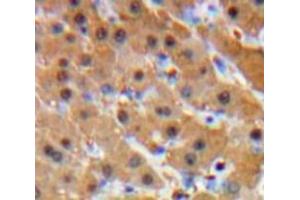 IHC-P analysis of Liver tissue, with DAB staining. (Glucocorticoid Receptor 抗体  (AA 564-733))