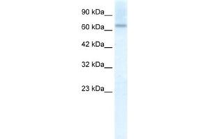 WB Suggested Anti-PIAS2 Antibody Titration:  2.