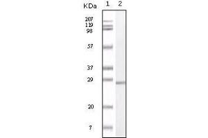 Western Blot showing S100A antibody used against truncated S100A recombinant protein. (S100A1 抗体)