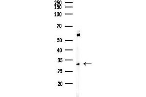 anti-Alkaline Ceramidase 1 (ACER1) (Internal Region) antibody