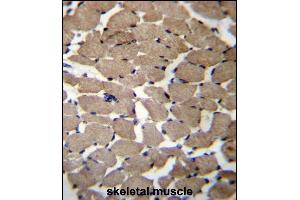 MGAT4C Antibody (C-term) (ABIN656550 and ABIN2845812) immunohistochemistry analysis in formalin fixed and paraffin embedded human skeletal muscle followed by peroxidase conjugation of the secondary antibody and DAB staining. (MGAT4C 抗体  (C-Term))