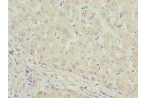 Immunohistochemistry of paraffin-embedded human liver tissue using ABIN7169532 at dilution of 1:100 (DHRS3 抗体  (AA 30-169))