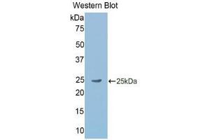 Western Blotting (WB) image for anti-Gastrokine 2 (GKN2) (AA 21-184) antibody (ABIN2117758) (Gastrokine 2 抗体  (AA 21-184))