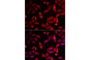Immunofluorescence analysis of HeLa cells using SERPINB9 antibody.