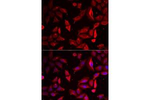 Immunofluorescence analysis of HeLa cells using SERPINB9 antibody. (SERPINB9 抗体  (AA 1-376))