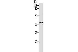 Western Blotting (WB) image for anti-Aldo-Keto Reductase Family 1, Member B1 (Aldose Reductase) (AKR1B1) antibody (ABIN2427538) (AKR1B1 抗体)