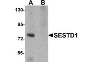 Western blot analysis of SESTD1 in rat brain tissue lysate with SESTD1 antibody at 1 μg/ml in (A) the absence and (B) the presence of blocking peptide.